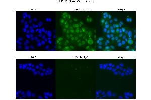 Sample Type :  MCF7   Primary Antibody Dilution:  4 ug/ml   Secondary Antibody :  Anti-rabbit Alexa 546   Secondary Antibody Dilution:  2 ug/ml   Gene Name :  PPP1R10