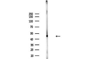 anti-T-Box 1 (TBX1) (Internal Region) antibody