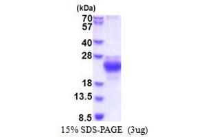 ChaC, Cation Transport Regulator Homolog 2 (CHAC2) (AA 1-184) protein (His tag)