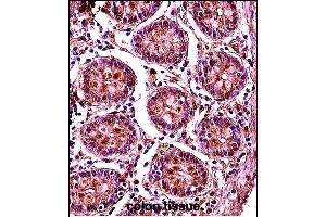 SMC1B Antibody (Center) (ABIN657773 and ABIN2846748) immunohistochemistry analysis in formalin fixed and paraffin embedded human colon tissue followed by peroxidase conjugation of the secondary antibody and DAB staining. (SMC1B Antikörper  (AA 737-765))