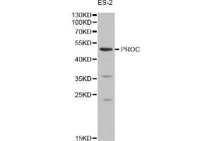 Western blot analysis of extracts of ES-2 cells, using PROC antibody (ABIN1874338) at 1:1000 dilution.