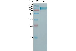 Human BCHE Protein, His Tag on SDS-PAGE under reducing condition.