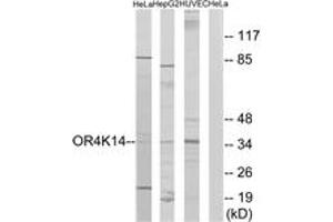 Western blot analysis of extracts from HeLa/HepG2/HuvEc cells, using OR4K14 Antibody.