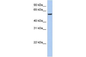 WB Suggested Anti-FBXO33 Antibody Titration: 0. (FBXO33 Antikörper  (Middle Region))