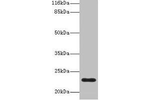 Western blot All lanes: C8G antibody at 2 μg/mL + Human serum Secondary Goat polyclonal to rabbit IgG at 1/10000 dilution Predicted band size: 23 kDa Observed band size: 23 kDa (C8G Antikörper  (AA 21-202))