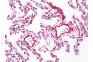 Anti-MCAM / CD146 antibody IHC staining of human lung. (MCAM Antikörper  (AA 84-189))
