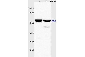 Lane 1: rat liver lysates Lane 2: rat brain lysates probed with Anti phospho-AKT1/2/3 (Tyr315/316/312) Polyclonal Antibody, Unconjugated (ABIN756217) at 1:200 in 4 °C. (AKT 1/2/3 Antikörper  (pTyr312, pTyr315, pTyr316))
