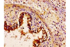 IHC image of ABIN7160568 diluted at 1:100 and staining in paraffin-embedded human lung tissue performed on a Leica BondTM system. (Myosin Antikörper  (AA 1058-1195))