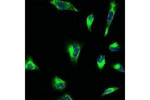 Immunofluorescent analysis of Vimentin staining in Hela cells.