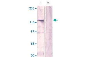 The whole cell lysate derived from LNCaP was immunoblotted by CSF1R polyclonal antibody  at 1 : 500.