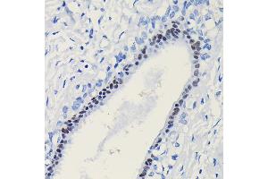 Immunohistochemistry (IHC) image for anti-Progesterone Receptor (PGR) (AA 1-250) antibody (ABIN6145518)
