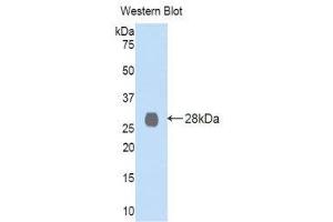 Western Blotting (WB) image for anti-Lysyl Oxidase-Like 2 (LOXL2) (AA 544-751) antibody (ABIN1859686) (LOXL2 Antikörper  (AA 544-751))