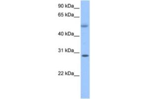 Western Blotting (WB) image for anti-Retinoic Acid Induced 12 (RAI12) antibody (ABIN2463621) (Retinoic Acid Induced 12 (RAI12) Antikörper)