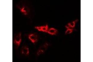 Immunofluorescent analysis of VPS37A staining in A549 cells.