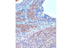 Immunohistochemistry of paraffin-embedded Rat ovary using B3GNT3 Rabbit pAb (ABIN7271204) at dilution of 1:100 (40x lens). (B3GNT3 Antikörper  (AA 120-240))