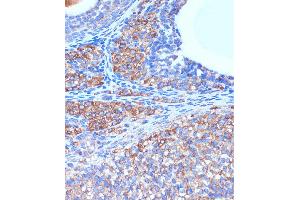 Immunohistochemistry of paraffin-embedded Rat ovary using B3GNT3 Rabbit pAb (ABIN7271204) at dilution of 1:100 (40x lens).