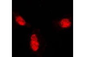 Immunofluorescent analysis of SUMO1 staining in A431 cells. (SUMO1 Antikörper  (N-Term))