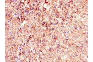 Immunohistochemistry of paraffin-embedded human adrenal gland tissue using ABIN7163679 at dilution of 1:100 (PHLDB2 Antikörper  (AA 734-1030))