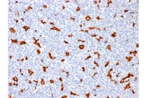 Immunohistochemistry (IHC) image for anti-Ionized Calcium-binding Adapter Molecule 1 (IBA1) (AA 1-146) antibody (ABIN6939298)