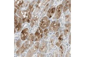 Immunohistochemical staining of human kidney with C14orf101 polyclonal antibody  shows cytoplasmic positivity in cells of renal tubules at 1:50-1:200 dilution. (C14orf101 Antikörper)