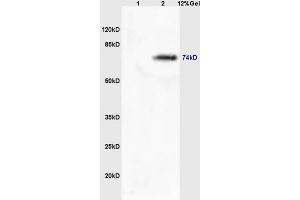 Lane 1: mouse lung lysates Lane 2: mouse brain lysates probed with Rabbit Anti-MASP2 Polyclonal Antibody, Unconjugated (ABIN676223) at 1:200 in 4 °C. (MASP2 Antikörper  (AA 351-450))