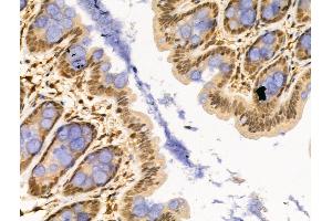 ABIN6257553 and ABIN6274359 at 1/100 staining Rat stomach tissue by IHC-P. (WTAP Antikörper  (C-Term))
