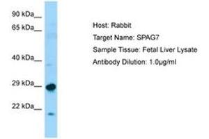 Image no. 1 for anti-Sperm Associated Antigen 7 (SPAG7) (N-Term) antibody (ABIN6750073) (SPAG7 Antikörper  (N-Term))