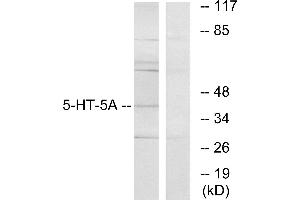 Western blot analysis of extracts from HeLa cells, using 5-HT-5A antibody. (Serotonin Receptor 5A Antikörper)