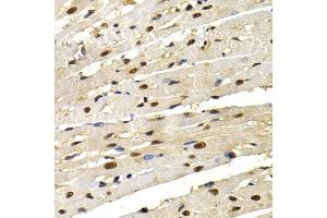 Immunohistochemistry (IHC) image for anti-Interferon Regulatory Factor 2 (IRF2) (AA 120-349) antibody (ABIN3023367)