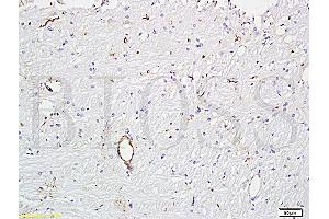 Formalin-fixed and paraffin embedded rat brain tissue (ABIN670506) at 1:300 followed by conjugation to the secondary antibody and DAB staining. (VWF Antikörper  (AA 701-800))