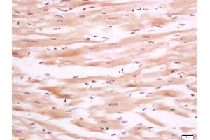 Immunohistochemistry (Paraffin-embedded Sections) (IHC (p)) image for anti-Protein tyrosine Phosphatase, Non-Receptor Type 3 (PTPN3) (AA 1-47) antibody (ABIN1386972)