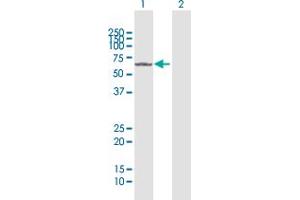 Western Blot analysis of FANCC expression in transfected 293T cell line by FANCC MaxPab polyclonal antibody. (FANCC Antikörper  (AA 1-558))