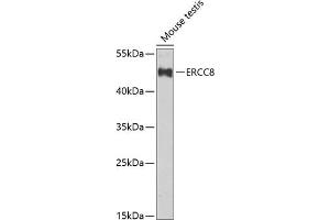 Western blot analysis of extracts of mouse testis, using ERCC8 Antibody (ABIN6134311, ABIN6140278, ABIN6140280 and ABIN6222611) at 1:1000 dilution. (ERCC8 Antikörper  (C-Term))