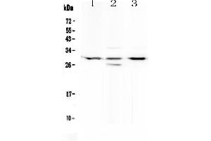 Western blot analysis of MED8 using anti-MED8 antibody . (MED8 Antikörper  (AA 1-195))
