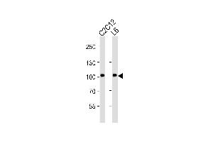 Western blot analysis of lysates from C2C12, L6 cell line (from left to right), using Musk Antibody (ABIN6242455 and ABIN6577083). (MUSK Antikörper  (AA 600-860))