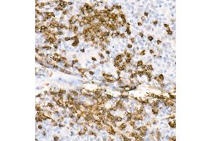 Immunohistochemistry (IHC) image for anti-Membrane-Spanning 4-Domains, Subfamily A, Member 1 (MS4A1) antibody (ABIN7268472)
