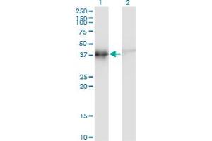 Western Blot analysis of ACTRT2 expression in transfected 293T cell line by ACTRT2 monoclonal antibody (M03), clone 2E10.