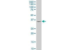PQBP1 polyclonal antibody (A01), Lot # 060707JCS1 Western Blot analysis of PQBP1 expression in MES-SA/Dx5 . (PQBP1 Antikörper  (AA 184-265))