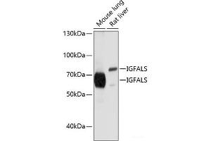 Western blot analysis of extracts of various cell lines using IGFALS Polyclonal Antibody at dilution of 1:1000. (IGFALS Antikörper)
