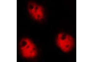 ABIN6268828 staining Hela by IF/ICC. (DDIT3 Antikörper  (Internal Region))