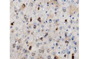 IHC analysis of MAP3K8 using anti-MAP3K8 antibody (ABIN4886663). (MAP3K8 Antikörper  (AA 9-193))