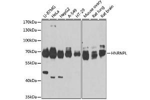 Western blot analysis of extracts of various cell lines, using HNRNPL antibody. (HNRNPL Antikörper)
