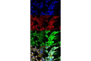 Immunocytochemistry/Immunofluorescence analysis using Mouse Anti-Methylglyoxal Monoclonal Antibody, Clone 9F11 . (Methylglyoxal (MG) Antikörper)