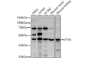 Western blot analysis of extracts of various cell lines, using ETV6 antibody (ABIN3022302, ABIN3022303, ABIN3022304, ABIN1512878 and ABIN6218719) at 1:1000 dilution. (ETV6 Antikörper  (AA 1-300))