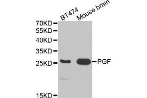 Western blot analysis of extracts of various cell lines, using PGF antibody. (PLGF Antikörper  (AA 19-170))