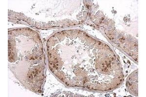 IHC-P Image Androgen Receptor antibody [N1], N-term detects Androgen Receptor protein at nucleus on mouse prostate by immunohistochemical analysis. (Androgen Receptor Antikörper  (N-Term))