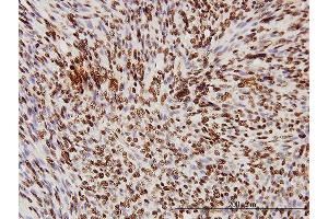 Immunostaining (ISt) image for anti-TAR DNA Binding Protein (TARDBP) (AA 1-260) antibody (ABIN565080)