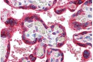 Human Placenta (formalin-fixed, paraffin-embedded) stained with HSPA5 antibody ABIN298116 at 10 ug/ml followed by biotinylated goat anti-rabbit IgG secondary antibody ABIN481713, alkaline phosphatase-streptavidin and chromogen. (GRP78 Antikörper  (AA 550-600))
