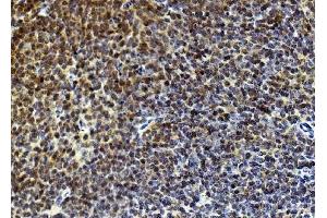 IHC analysis of Rad9/Rad9a using anti-Rad9/Rad9a antibody (ABIN7599342). (RAD9A Antikörper  (AA 1-389))