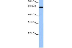WB Suggested Anti-COL4A3BP Antibody Titration: 0. (COL4A3BP Antikörper  (N-Term))